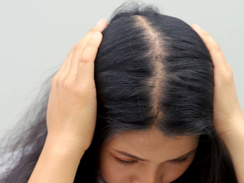 Gravidez e queda de cabelo: o que é normal e quando procurar ajuda